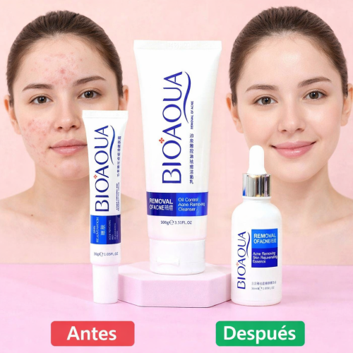 ✨ Kit Bioaqua Eliminador de Acné – Limpieza Profunda y Piel Más Clara